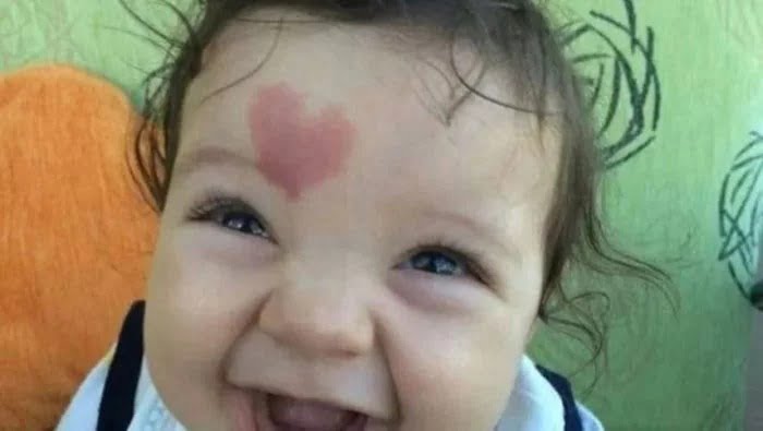 “El bebé del amor”: nació con una mancha en forma de corazón y es viral