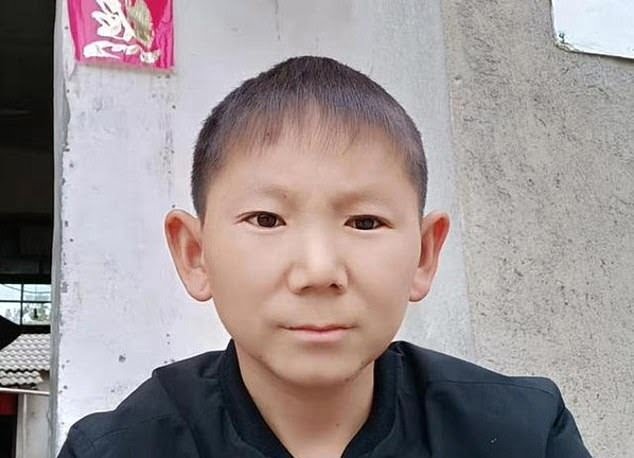 La increíble historia de un hombre de 34 años atrapado en el cuerpo de un niño de 6