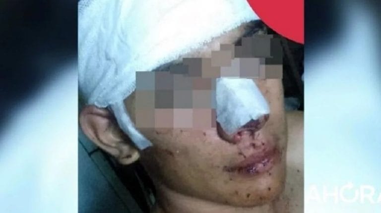 Sucedió en Entre Ríos: Una patota abusó de su novia, quiso defenderla y le dieron una paliza salvaje