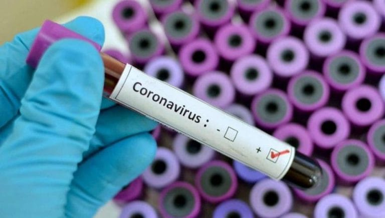 Hoy se detectaron 12 casos de COVID-19 en La Pampa