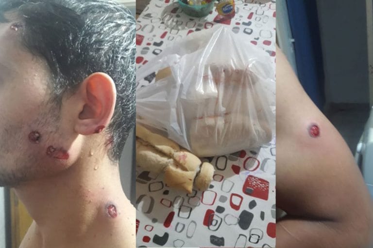 General Pico: un hombre hospitalizado con varias heridas por disparos con balas de goma en Barrio Malvinas