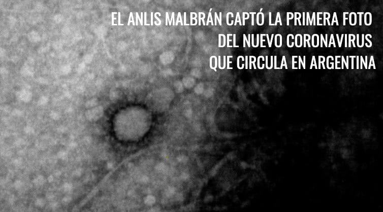 Científicos del Malbrán y del Conicet lograron sacarle una foto al coronavirus