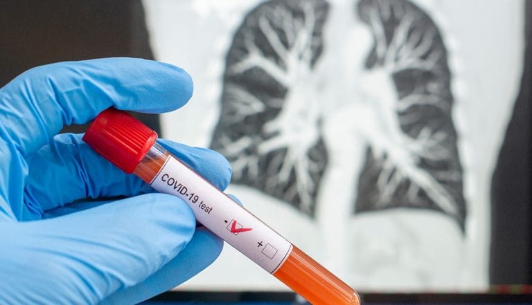 La Pampa cumple 42 días sin casos positivos de coronavirus