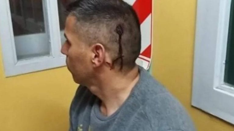 El preso, golpeado por sus vecinos al llegar a su casa de Esquel: “Cometí errores pero los pagué ante la Justicia”