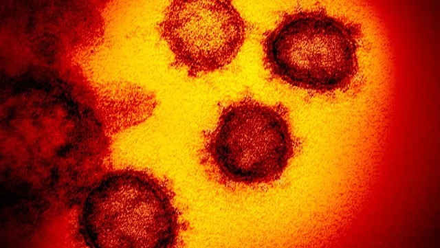 Israel desarrolló un anticuerpo para neutralizar el coronavirus