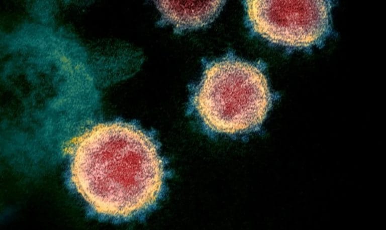 Esperanza: Hallan anticuerpos “completamente humanos” capaces de bloquear el coronavirus
