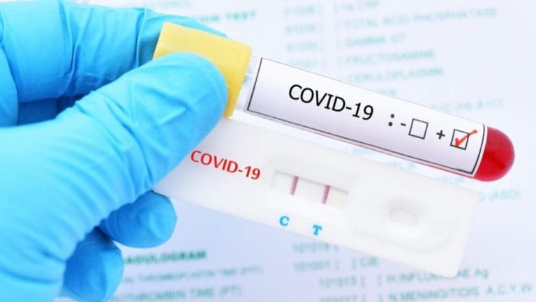 Coronavirus: 21 nuevos casos positivos en La Pampa y suman 108 en total