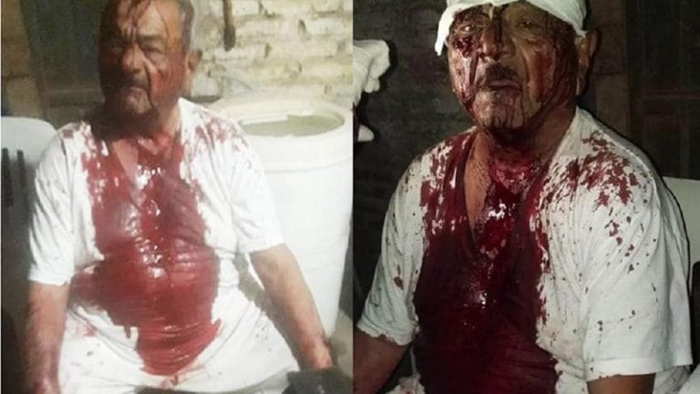 Indignación en Santa Fe: tres jóvenes golpearon con hierros y palos a un jubilado para robarle una olla y la garrafa