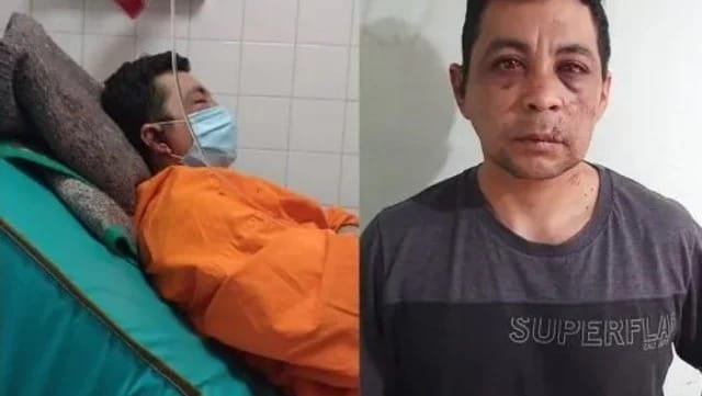 Vecinos golpearon y le incendiario la casa a un enfermero recuperado de coronavirus en Neuquén