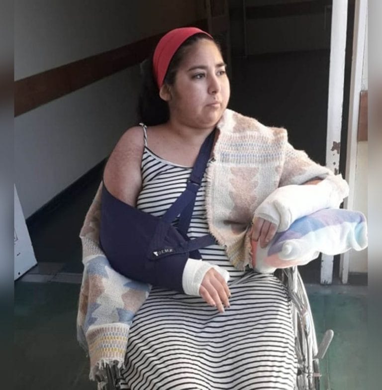 General Pico: Micaela Vega debe colocarse una prótesis y necesita de la colaboración de todos