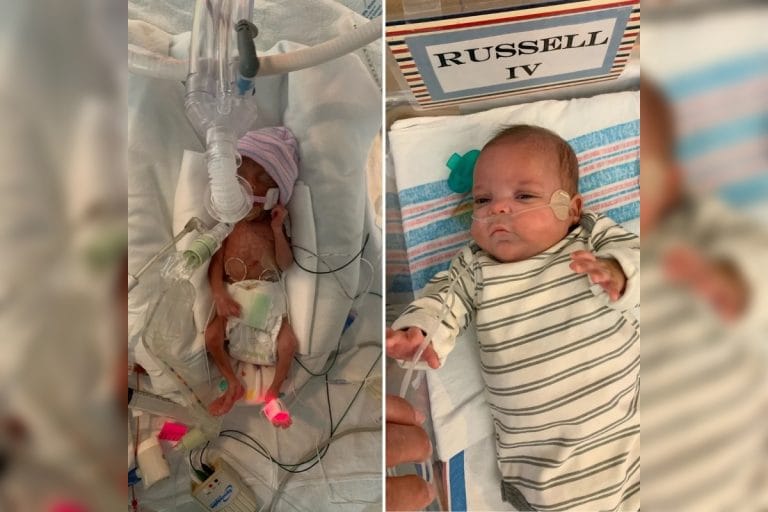 El bebé del milagro: nació con 454 gramos y tras 133 días internado en terapia ya está en su casa
