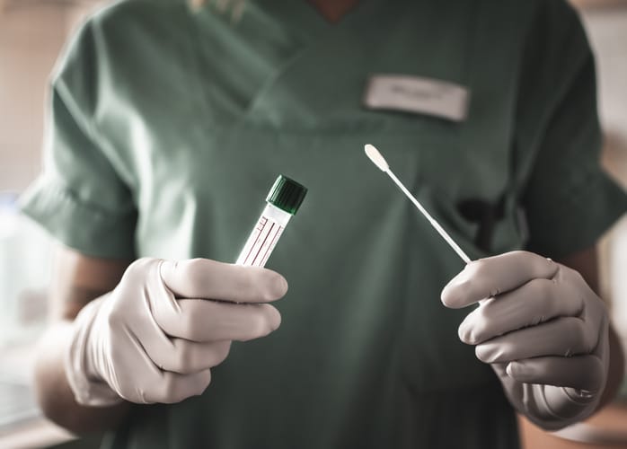 La Pampa comenzó a realizar “test rápidos”: 5 dieron positivos de los 14 que se realizaron