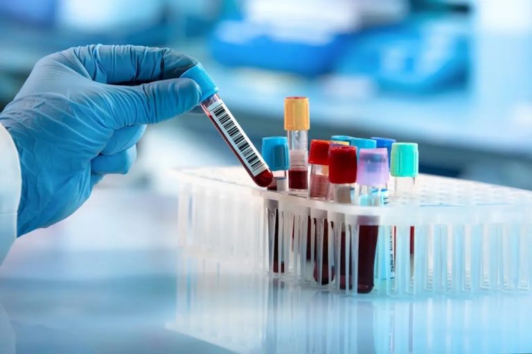 La Anmat aprobó el test argentino para la detección rápida de coronavirus