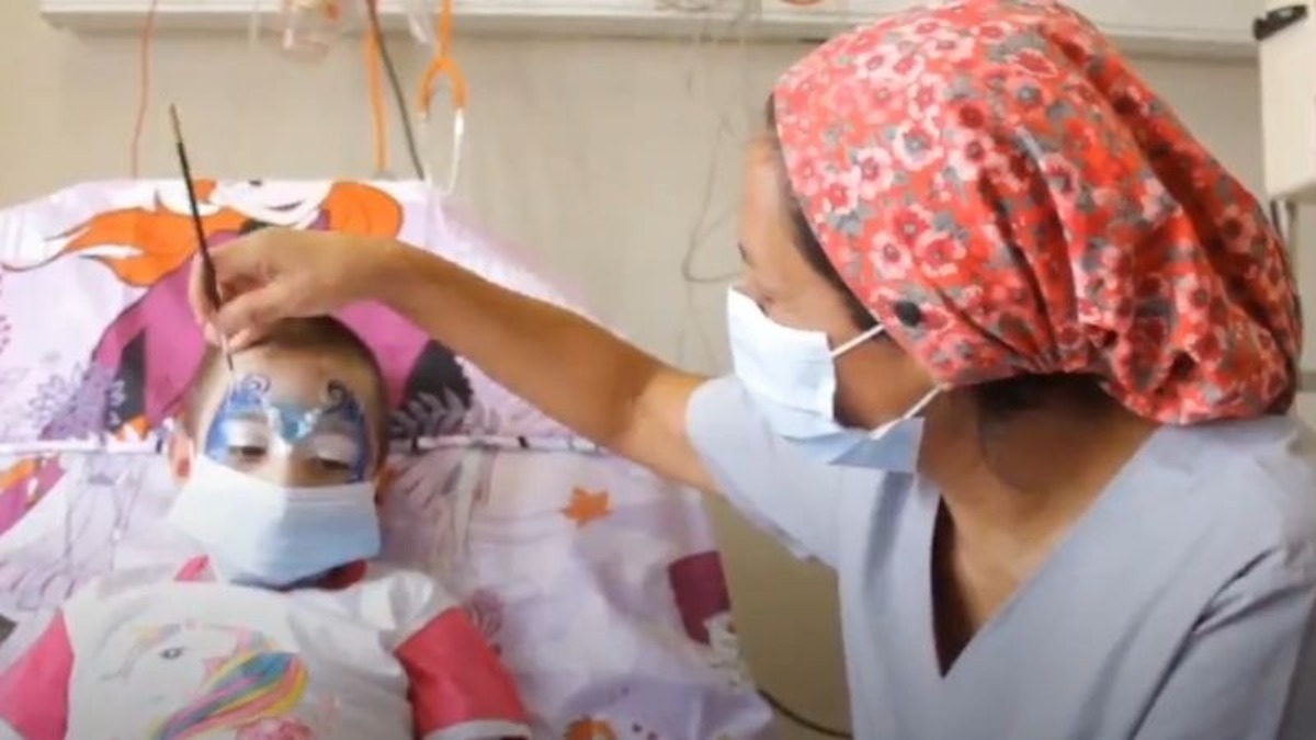 Conmovedor: enfermeras del Garrahan maquillan a niños con quemaduras graves para estimular su recuperación