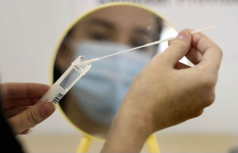 Coronavirus: ANMAT autorizó la venta en farmacias del test rápido que detecta el virus en 10 minutos