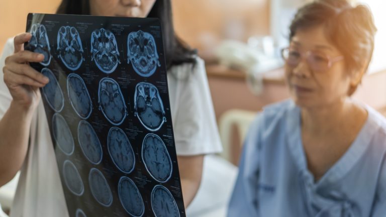 Día Mundial del ACV: una lesión cerebral con efectos devastadores para el individuo y su familia