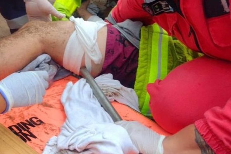 Peligrosas ráfagas de viento en Mar del Plata: una sombrilla voló por la playa, se clavó en la pierna de un joven y se la sacaron con una motosierra