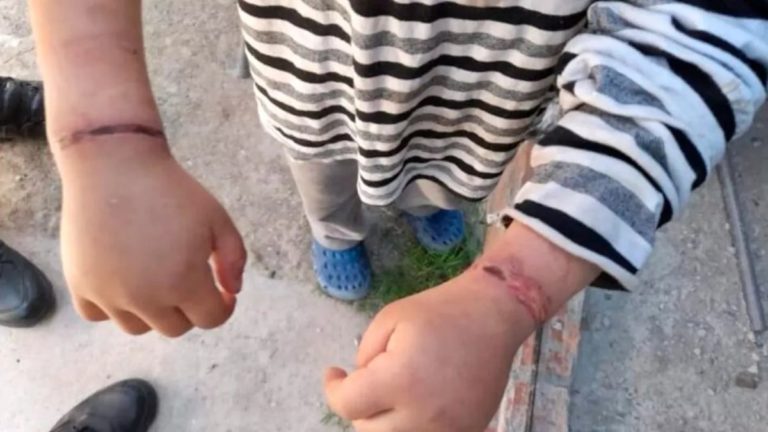 Maltrato infantil: Rescataron a un nene que había sido atado con alambres por su madre en Moreno