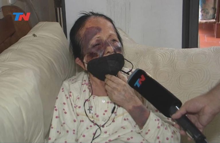 “Así me dejaron”: la salvaje golpiza a una jubilada en San Martín para robarle