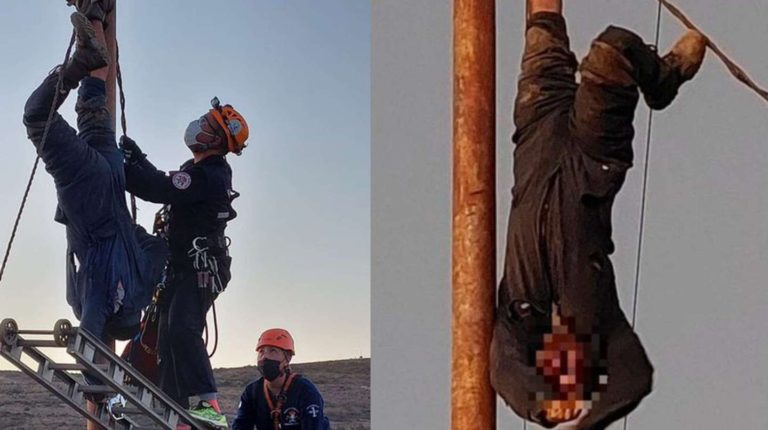 Le amputarán el brazo al hombre que se trepó a robar cables en Chubut y quedó electrocutado