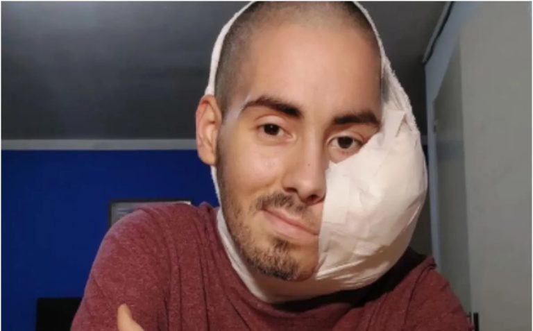 “Ya no sufre más”: Sebastián Amurín, el joven que tenía un tumor en la cara, murió a los 25 años