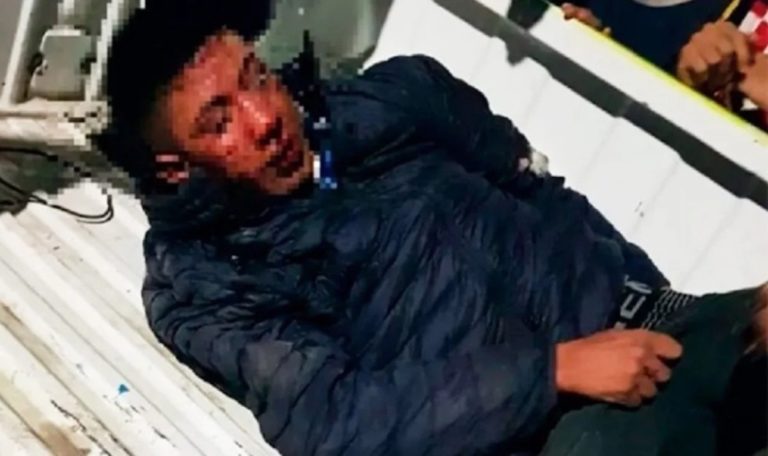 Brutal linchamiento en Tucumán: vecinos atraparon a un motochorro y le cortaron dos dedos