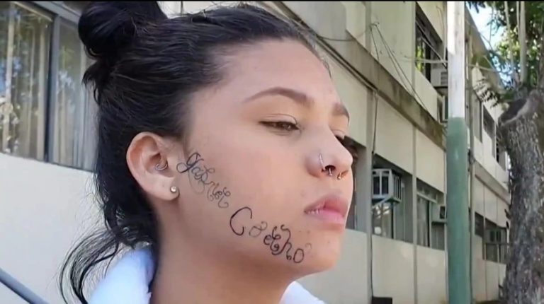 Brasil: su exnovio la secuestró y le tatuó el nombre en la cara para “marcarla como su propiedad”