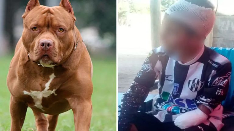 Tiene 13 años y le amputaron el brazo izquierdo tras ser atacado por pitbulls en Santiago del Estero: “A mi nieto lo entregaron”