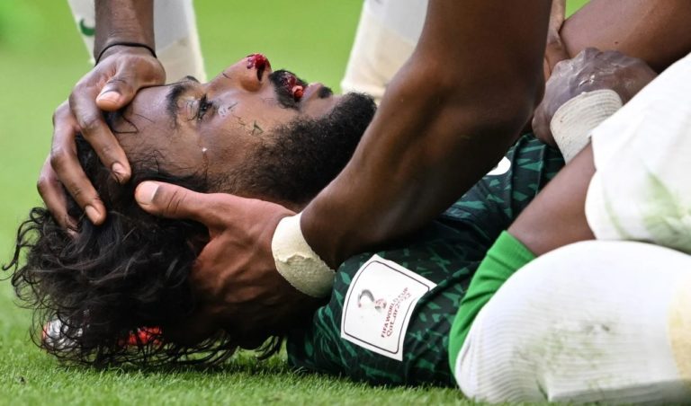 “Recen por mí”: el desesperado pedido del defensor de Arabia golpeado ante Argentina