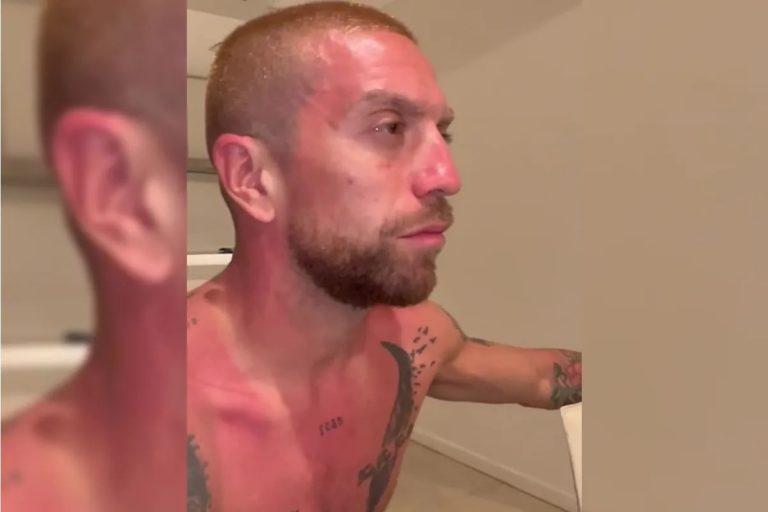 “Papu” Gómez mostró cómo quedó luego de los festejos en la caravana de la selección