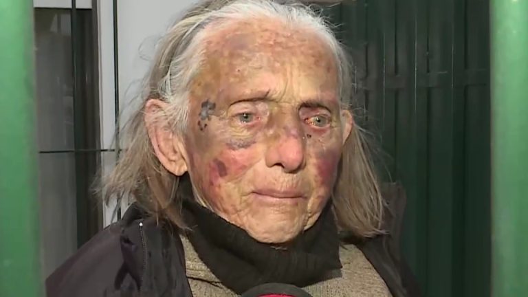 Brutal golpiza a una anciana de 86 años para robarle en Virrey del Pino
