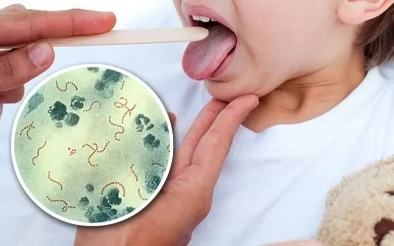 La Pampa: sin casos reportados de Streptococcus Pyogenes, permanece en alerta mientras nación confirma 118 casos y 16 muertes