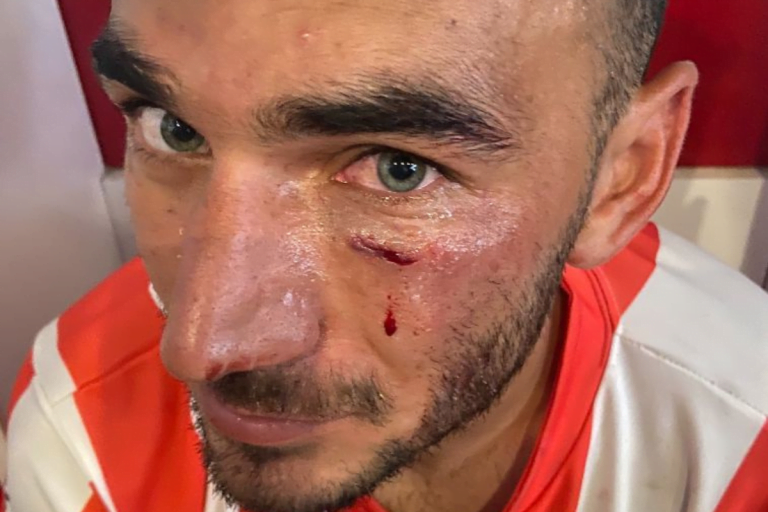 Así terminó Rodrigo Martín por el golpe sufrido de un rival: “es una lástima que haya terminado así”, expresó el jugador de Costa