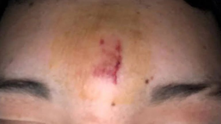 Rosario: un docente le arrojó un borrador a un alumno para callarlo, le lastimó la frente y fue suspendido