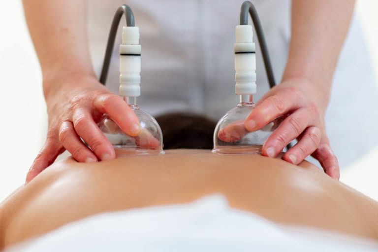 Vacumterapia con Macota Espada: una técnica ancestral modernizada para la rehabilitación