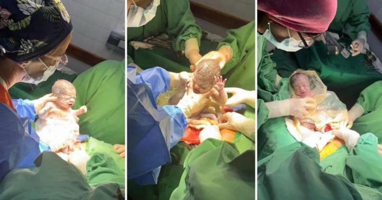 Milagro en Salta: nacen trigemelas idénticas en un parto excepcional
