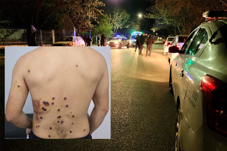 General Pico: formalizaron por lesiones graves al policía que le disparó a un joven con una escopeta antitumulto