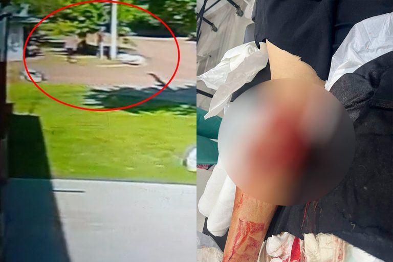 Se agrava el estado del hombre atacado por un dogo en Intendente Alvear: será trasladado de urgencia a Santa Rosa