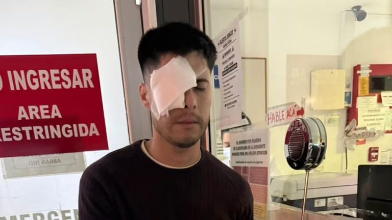 Drama en Cosquín: un pampeano podría perder la visión tras ser herido por pirotecnia en pleno festival